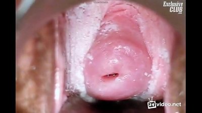 一個美麗的女人的婦科檢查